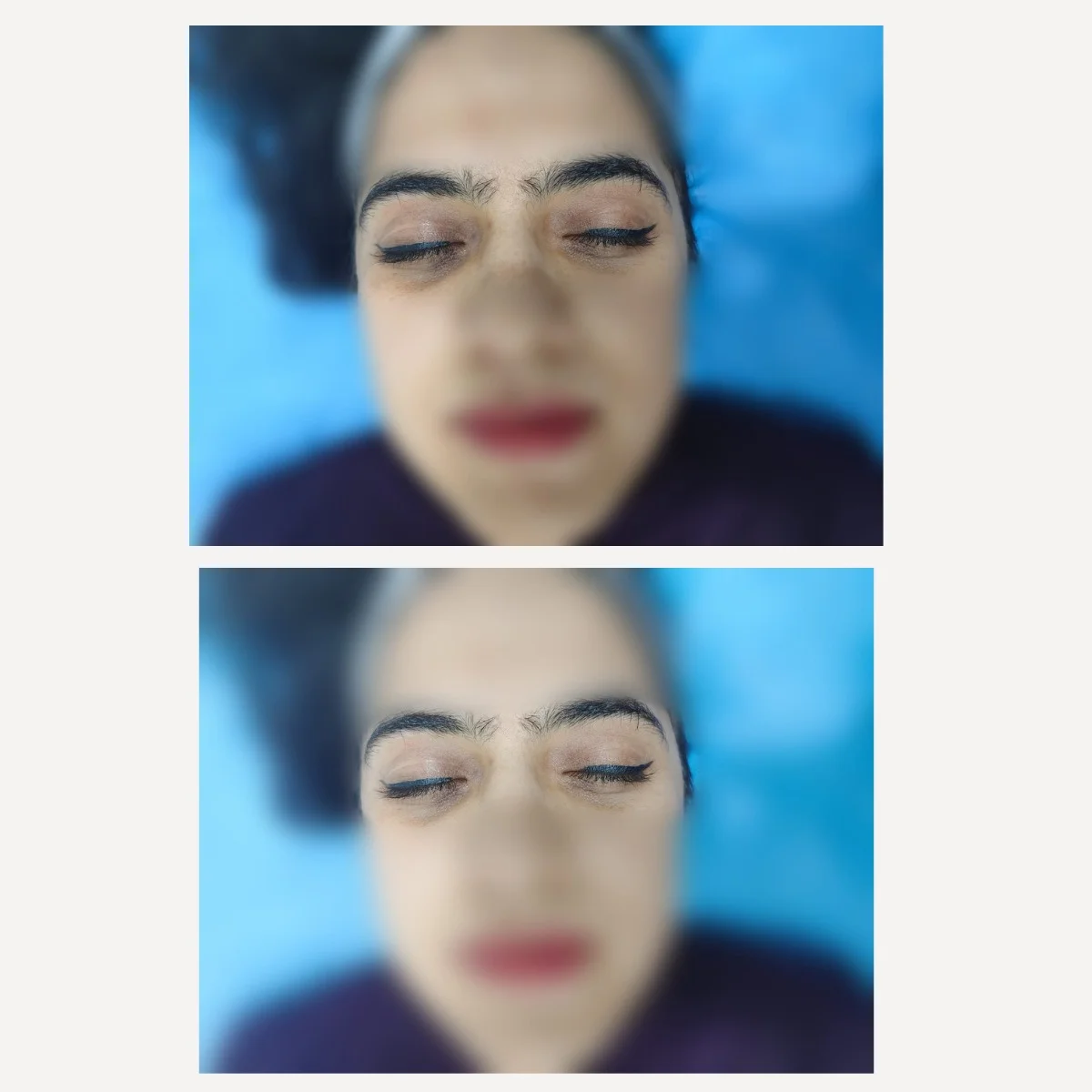 Under Eye Brightening